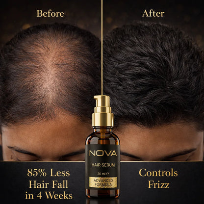 NOVA Hair Serum - For Men & Women