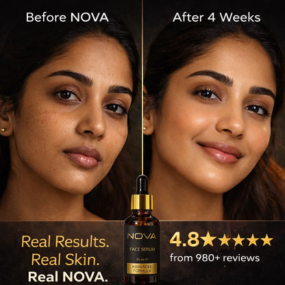 NOVA Face Serum - All Skin Types