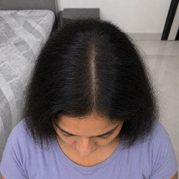 After
