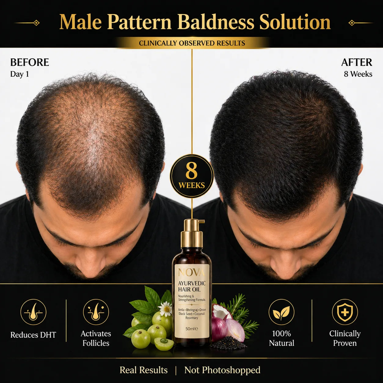 NOVA Ayurvedic Hair Oil - 50ml